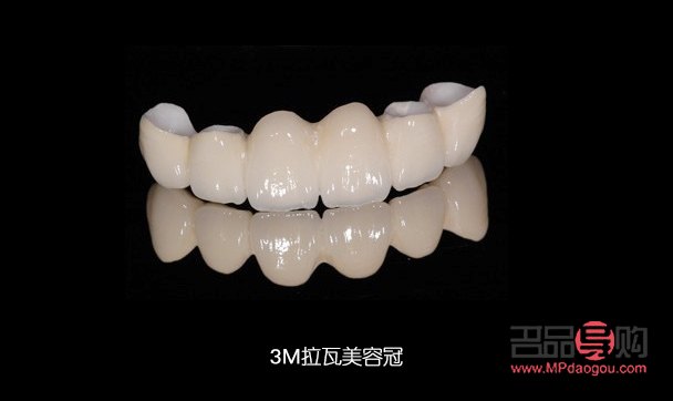 <h3>美容冠：美麗與健康的雙重保障</h3>