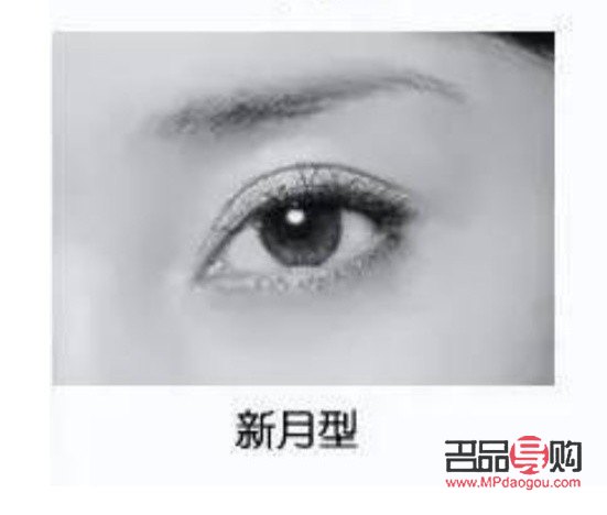 平行雙眼皮改新月形雙眼皮，你想知道的都在這里！