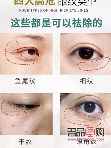 眼睛下邊長皺紋是怎么回事(眼睛下邊長皺紋是怎么回事兒)