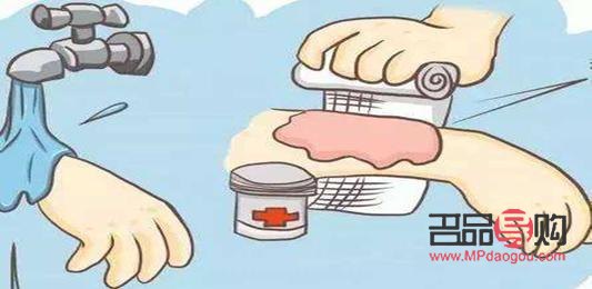 身體燙傷后最佳護(hù)理方法全解析
