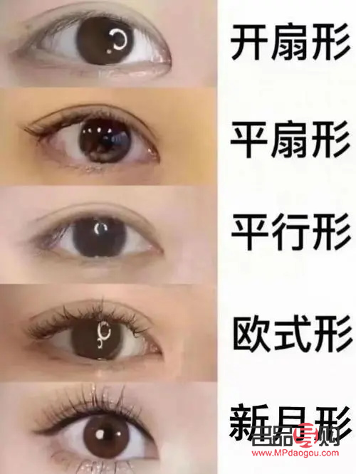 平扇型雙眼皮恢復(fù)圖詳解