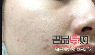 <h3>身體乳與手部護理：一種多功能的護膚選擇</h3>