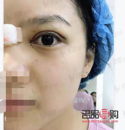 宜昌雙眼皮整形，哪家醫(yī)院更出眾？