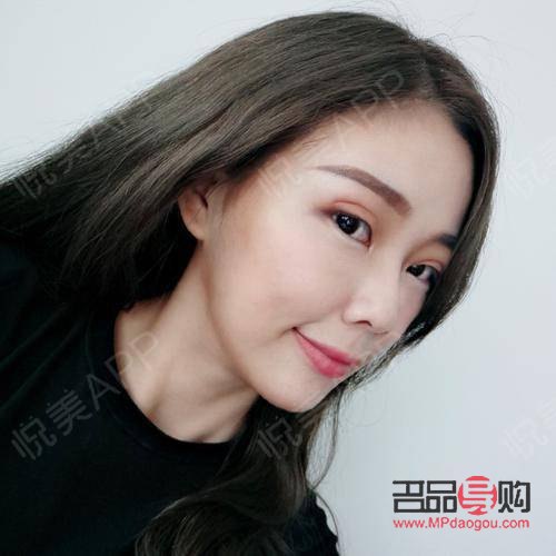 雙眼皮手術：如何選擇最佳方案？