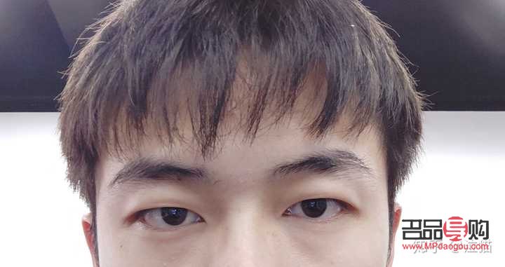 <h3>眼睛高低不對(duì)稱怎么辦？專業(yè)解答與實(shí)用建議</h3>