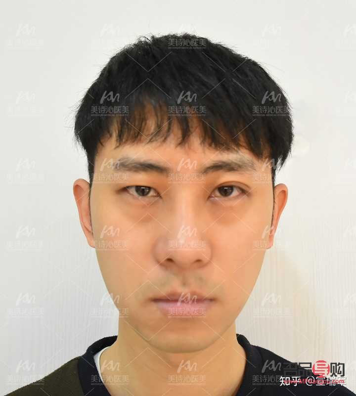 <h3>眼睛高低不對(duì)稱怎么辦？專業(yè)解答與實(shí)用建議</h3>