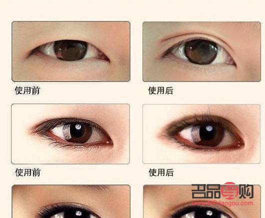 雙眼皮的魅力：哪些人更適合擁有雙眼皮？