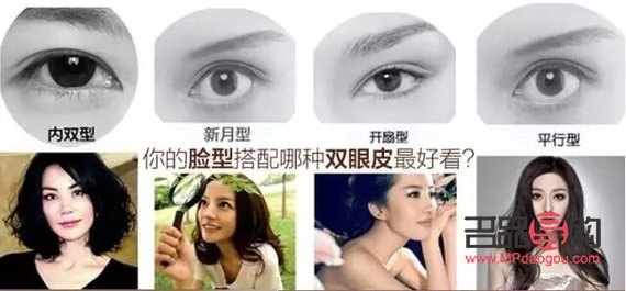 <h3>探索雙眼皮之美：哪種雙眼皮最好看且安全可靠？</h3>