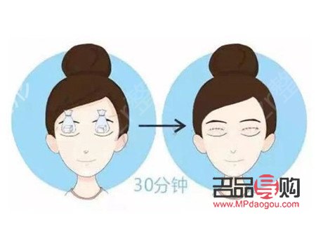 <h3>腫眼泡按摩能否有效消除？</h3>