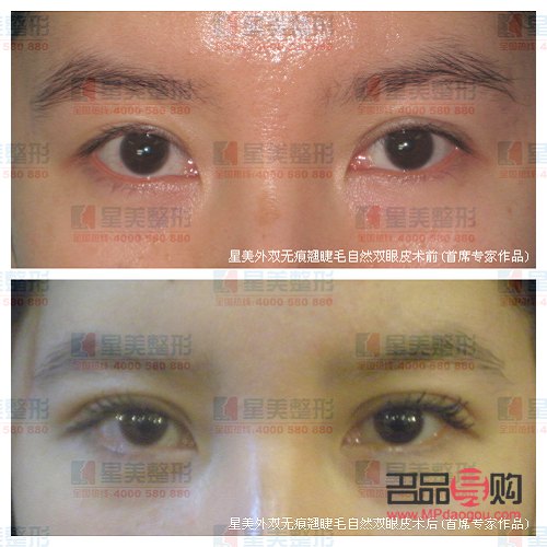 美容醫保報銷嗎(整形美容科醫保報銷嗎)