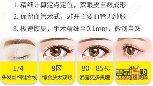 雙眼皮手術的眼綜合包括哪些項目(雙眼皮眼綜合手術包括什么項目)