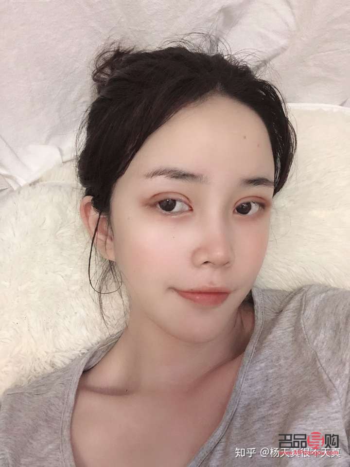 探索雙眼皮手術(shù)：哪種雙眼皮最自然、最好看？