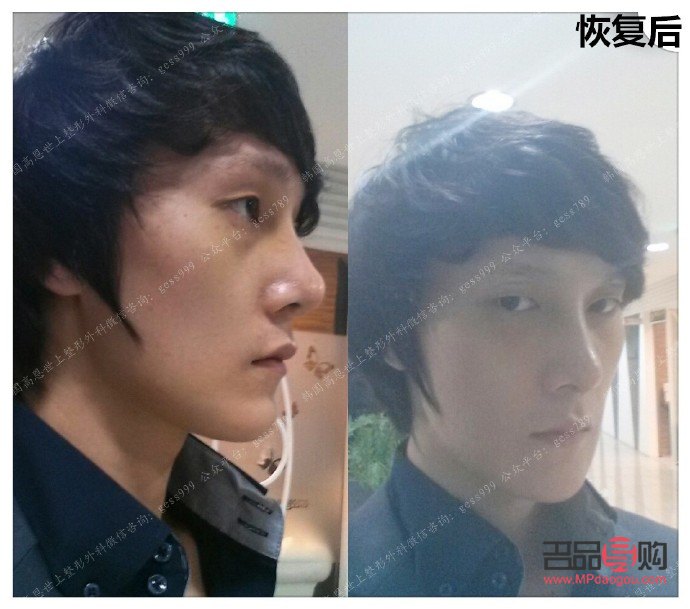 在哪個整形美容好(哪個整形美容醫院好)