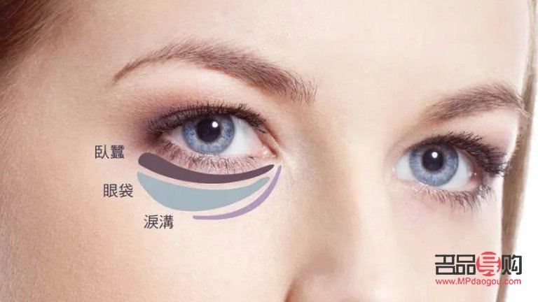探究眼袋形成之謎：成因、影響與解決方案