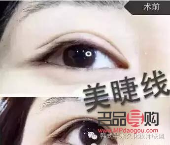 內雙紋眼線與美瞳線，哪個更具魅力？