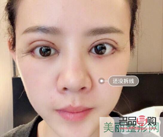 <h3>西安市雙眼皮整形優選之地</h3>