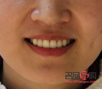 &amp;lt;h1&amp;gt;牙齒美容：綻放自信笑容的秘密武器&amp;lt;/h1&amp;gt;