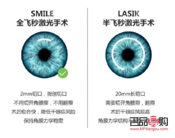 凸眼球矯正手術多少錢(凸眼球矯正手術多少錢)