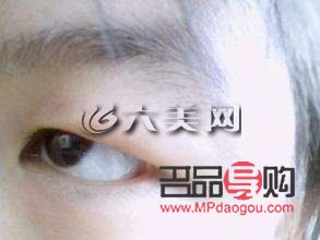 <h3>消除腫眼泡的有效非手術方法</h3>