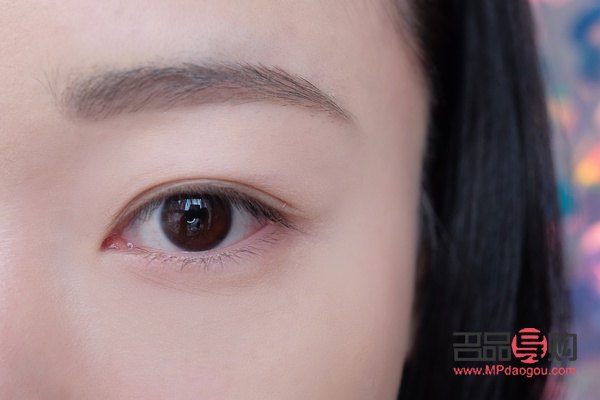 全切雙眼皮大小眼問題解決方案：調整眼型策略