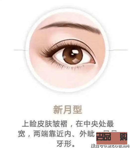 新月型雙眼皮與平扇形雙眼皮的區別