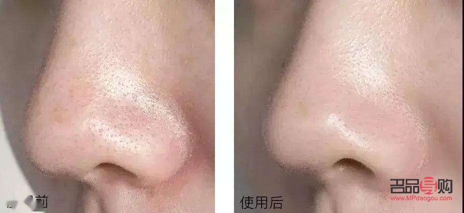 眼部保養手法：呵護明眸，告別歲月痕跡