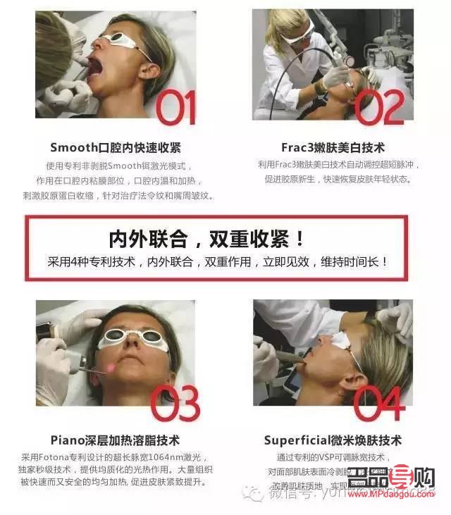fotona眼部抗衰299套餐(fotona和超聲炮的區別)