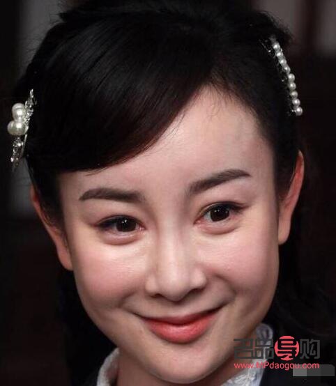 眼下八字淚溝怎么去除(眼下八字淚溝怎么去除圖片)