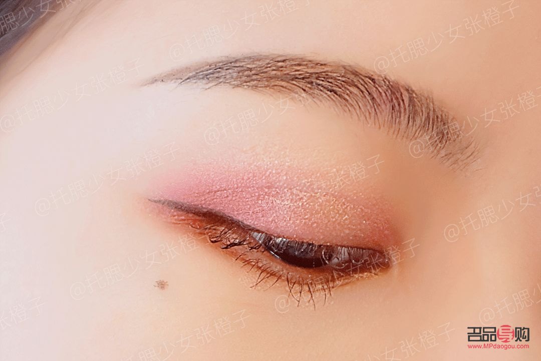 探索子雙眼皮手術：打造迷人雙眼的秘密武器