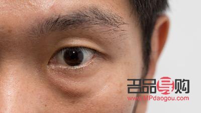 男士去眼袋黑眼圈用什么(男士去眼袋黑眼圈用什么產品效果比較好)