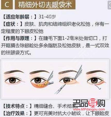 內切眼袋可以維持幾年(內切眼袋可以維持幾年壽命)