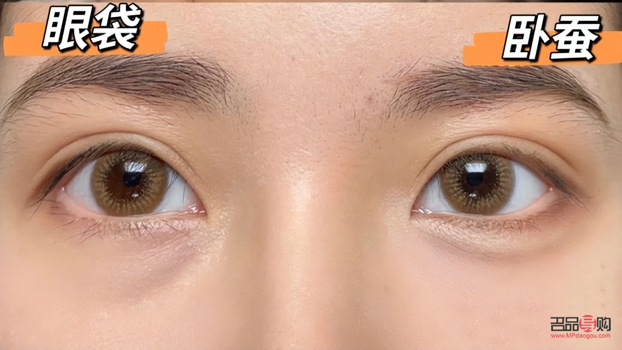 臥蠶和眼袋有什么區別面相圖片(臥蠶和眼袋有什么區別面相圖片女)