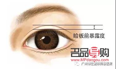 <h3>眼皮松弛適合做哪種雙眼皮</h3>