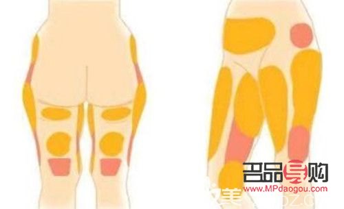 做了抽脂如何護理身體(做了抽脂如何護理身體好)