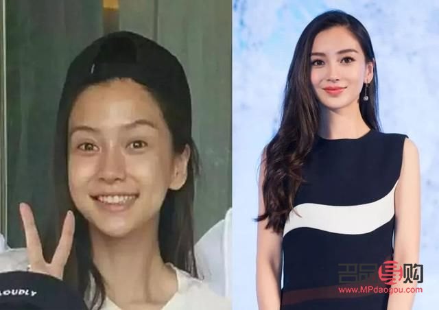 雙眼皮肉條太厚能修復嗎(雙眼皮肉條太厚能修復嗎圖片)