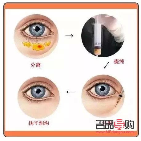 紅霉素眼膏去眼袋的最快方法