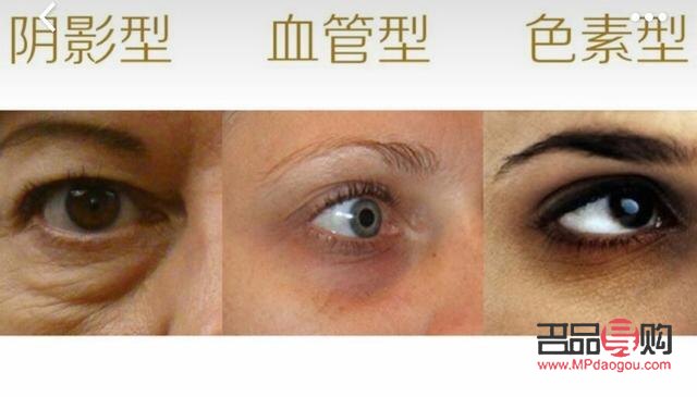 怎么樣保養眼睛不產生眼袋和淚溝(怎么樣保養眼睛不產生眼袋和淚溝的方法)