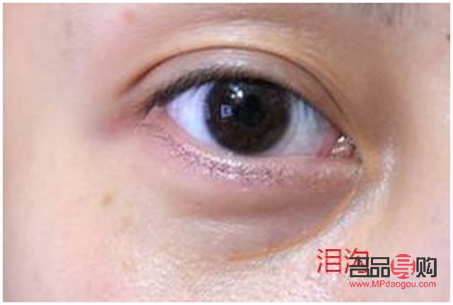 怎么樣保養眼睛不產生眼袋和淚溝(怎么樣保養眼睛不產生眼袋和淚溝的方法)