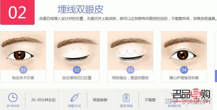 無(wú)痕跡雙眼皮與埋線雙眼皮的區(qū)別詳解