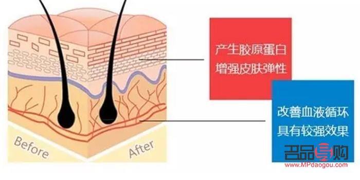 <h3>美容面部線雕：塑造青春輪廓的秘籍</h3>