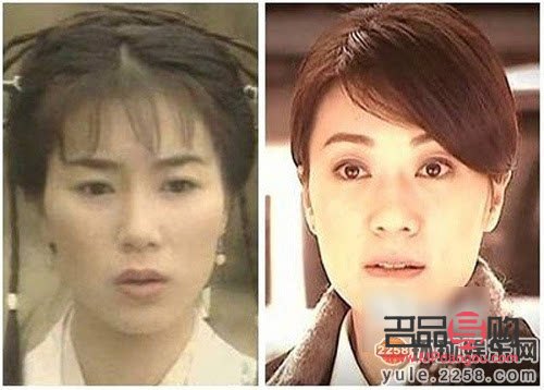 <h3>美容面部線雕：塑造青春輪廓的秘籍</h3>