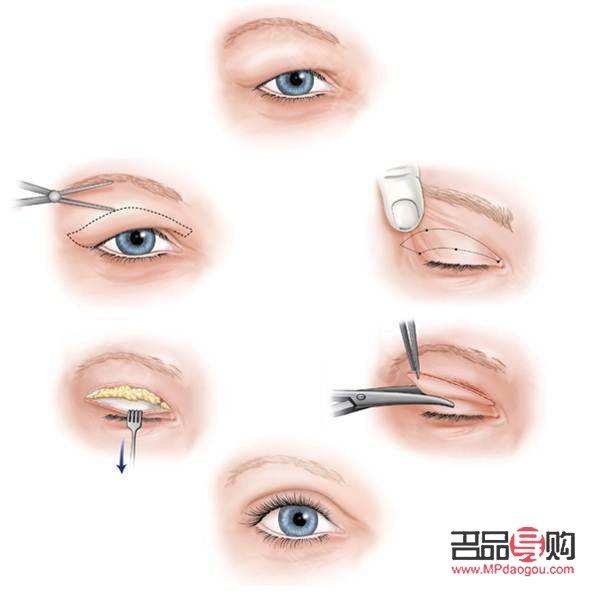 <h3>雙眼皮腫眼泡怎么化妝</h3>