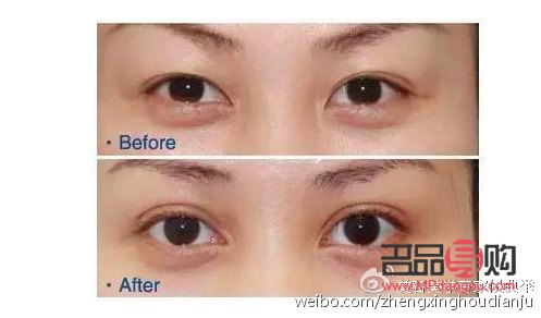 怎么可以讓內雙變成外雙雙眼皮(怎么可以讓內雙變成外雙雙眼皮圖片)