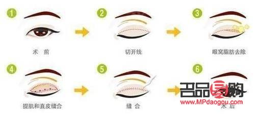 眼綜合一共有多少個項目(眼綜合一共有多少個項目可以做)