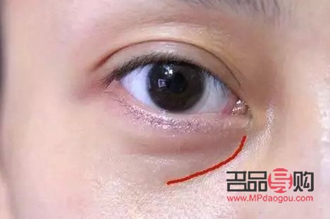 <h3>去眼袋哪個品牌好？專業評測為你揭秘！</h3>