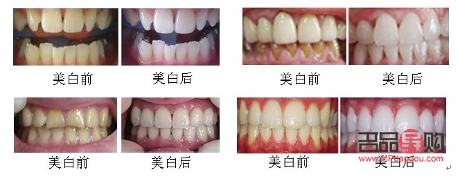 美容院整牙齒嗎？專業(yè)解答與注意事項(xiàng)