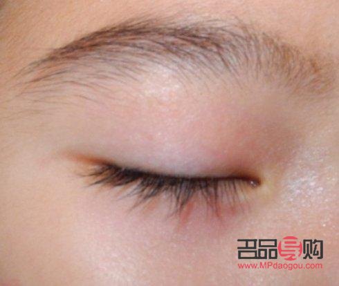 如何揉出雙眼皮疤痕：專業指導與注意事項