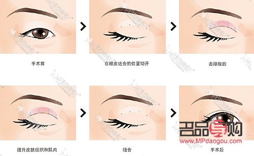 <h3>眼綜合全部項目詳解：打造迷人電眼</h3>
