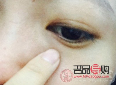 眼皮下垂怎么自然恢復吃什么好(眼皮下垂怎么做會改善)