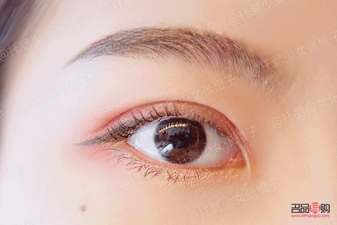 雙眼皮能割第二次嗎？詳解雙眼皮二次手術的可能性與注意事項